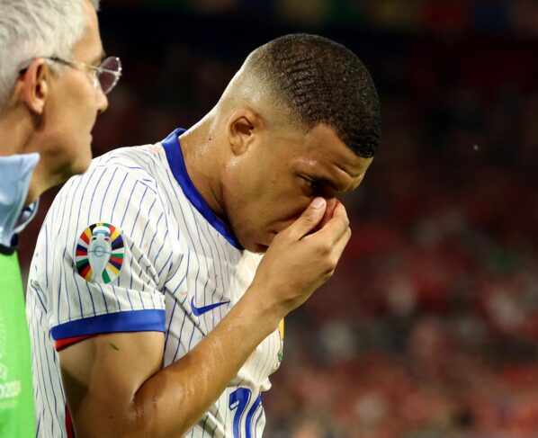 Com nariz quebrado, Mbappé deve ser desfalque contra a Holanda